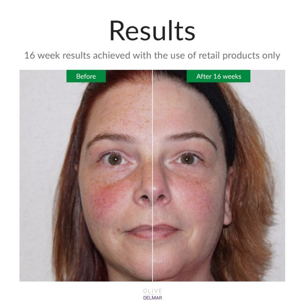 afa Product Before & After