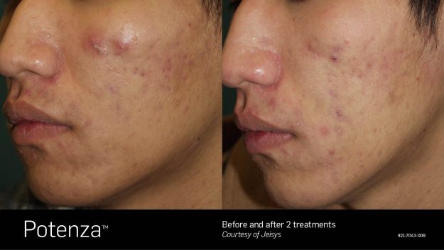 Potenza B&A 3D